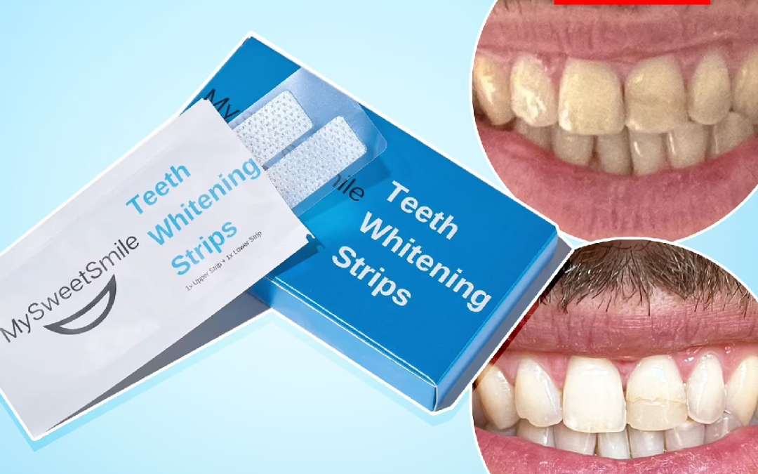 Teeth Whitening Strips Price in Pakistan